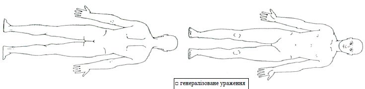 ВИСИПКА