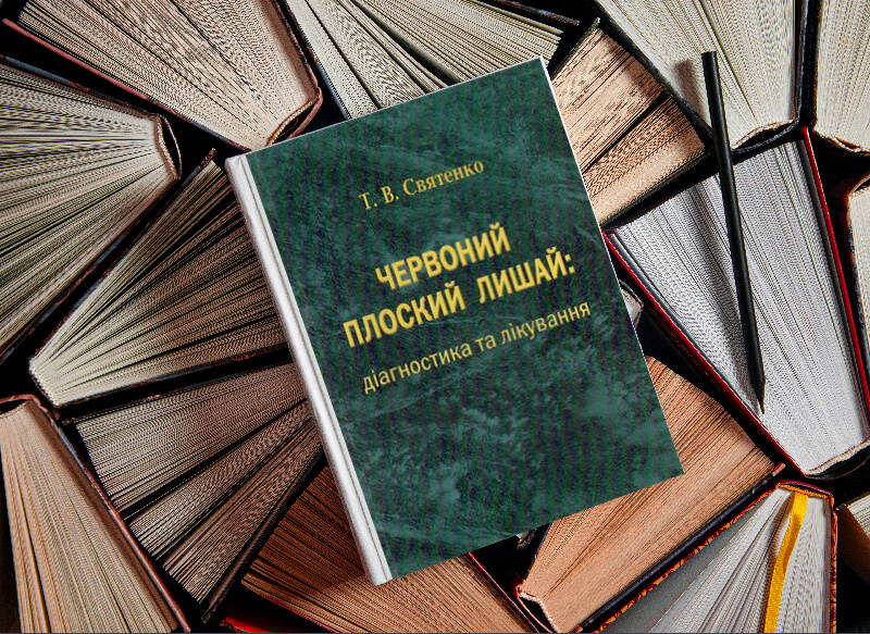 Червоний плоский лишай