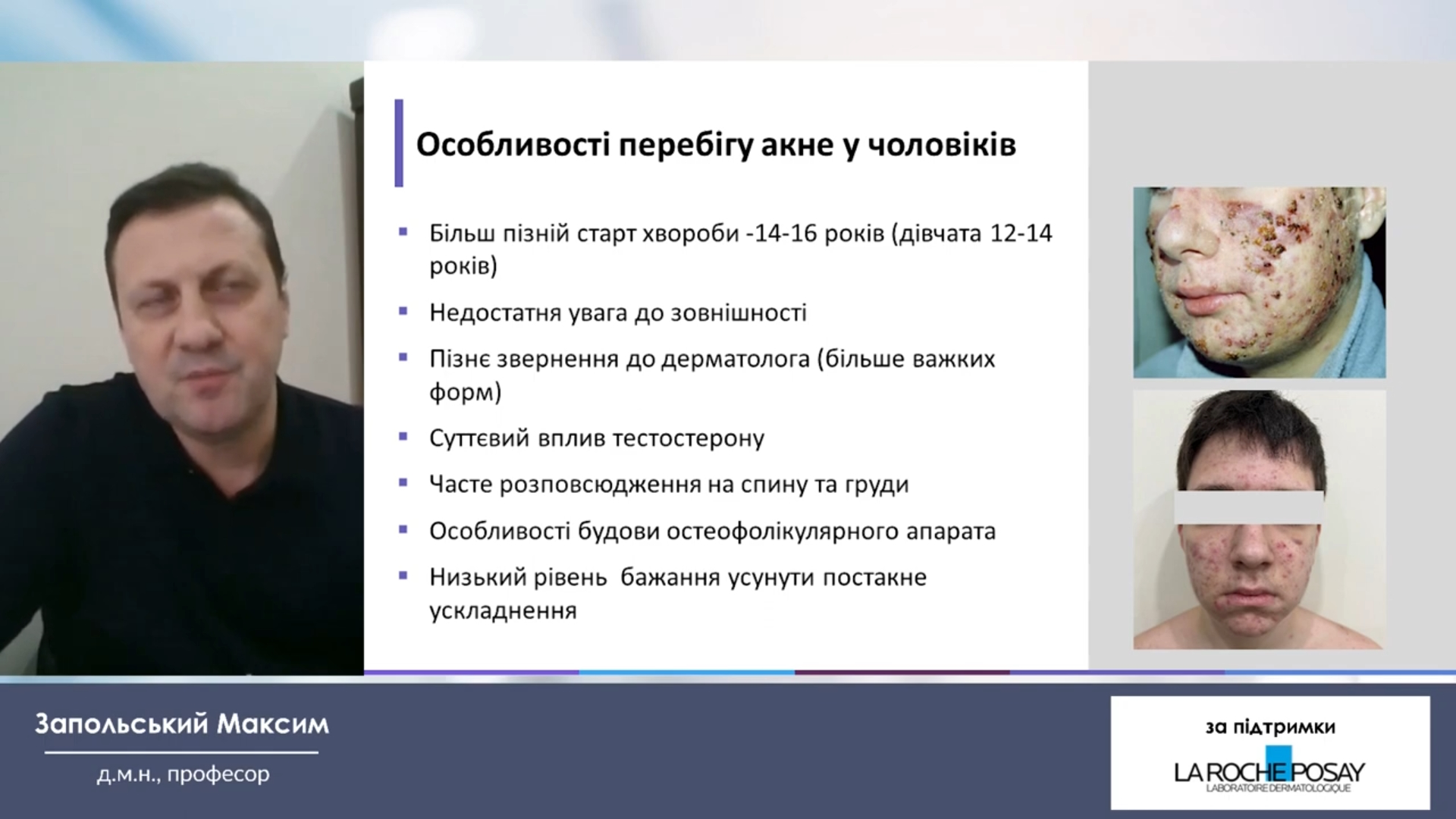 Акне, актуальність догляду за шкірою чоловіків