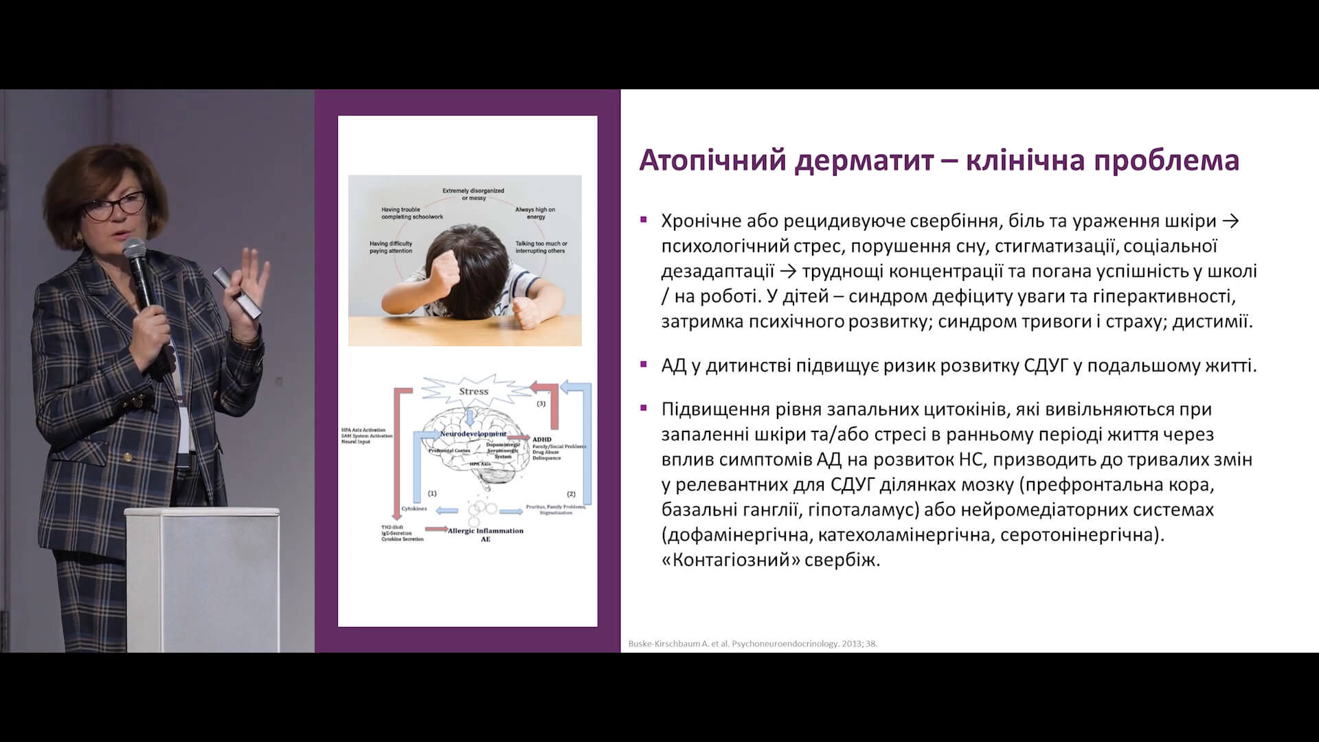 Сучасні підходи до зовнішньої терапії атопічного дерматиту: топічні інгібітори кальциневрину
