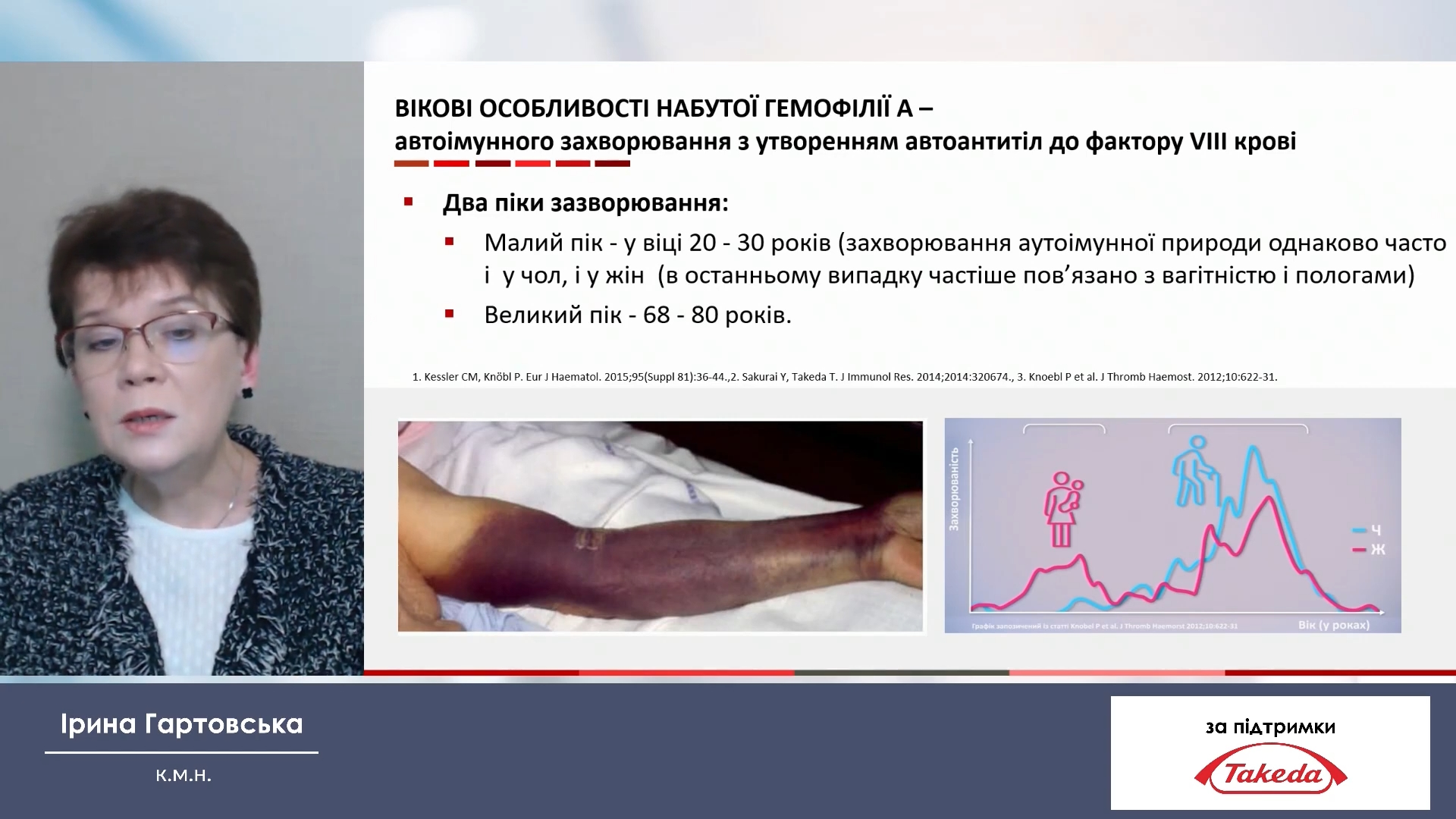 Причини виникнення підшкірних крововиливів (частина друга)