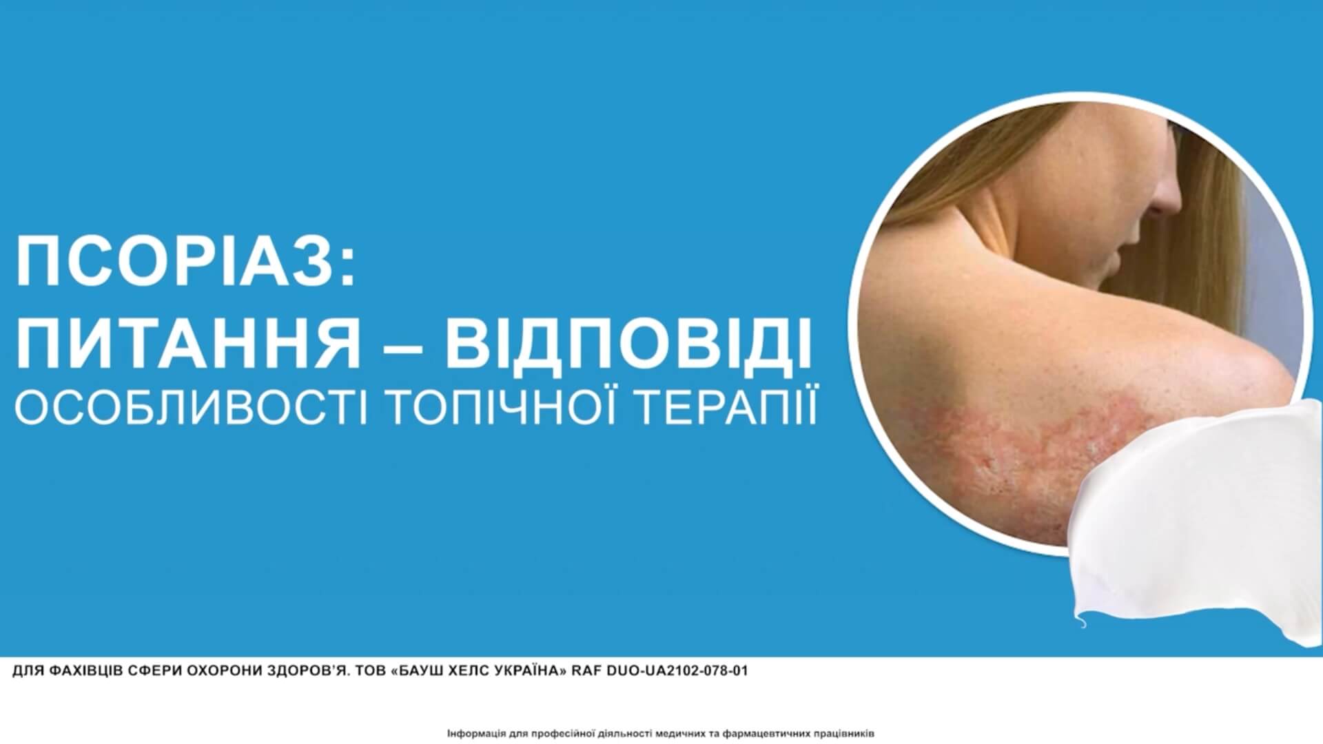 Псоріаз: особливості топічної терапії