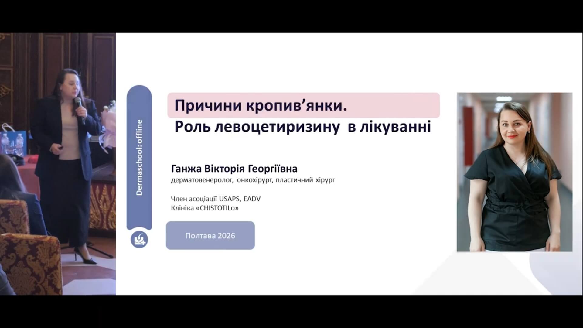Причини кропив'янки. Роль левоцетиризину в лікуванні