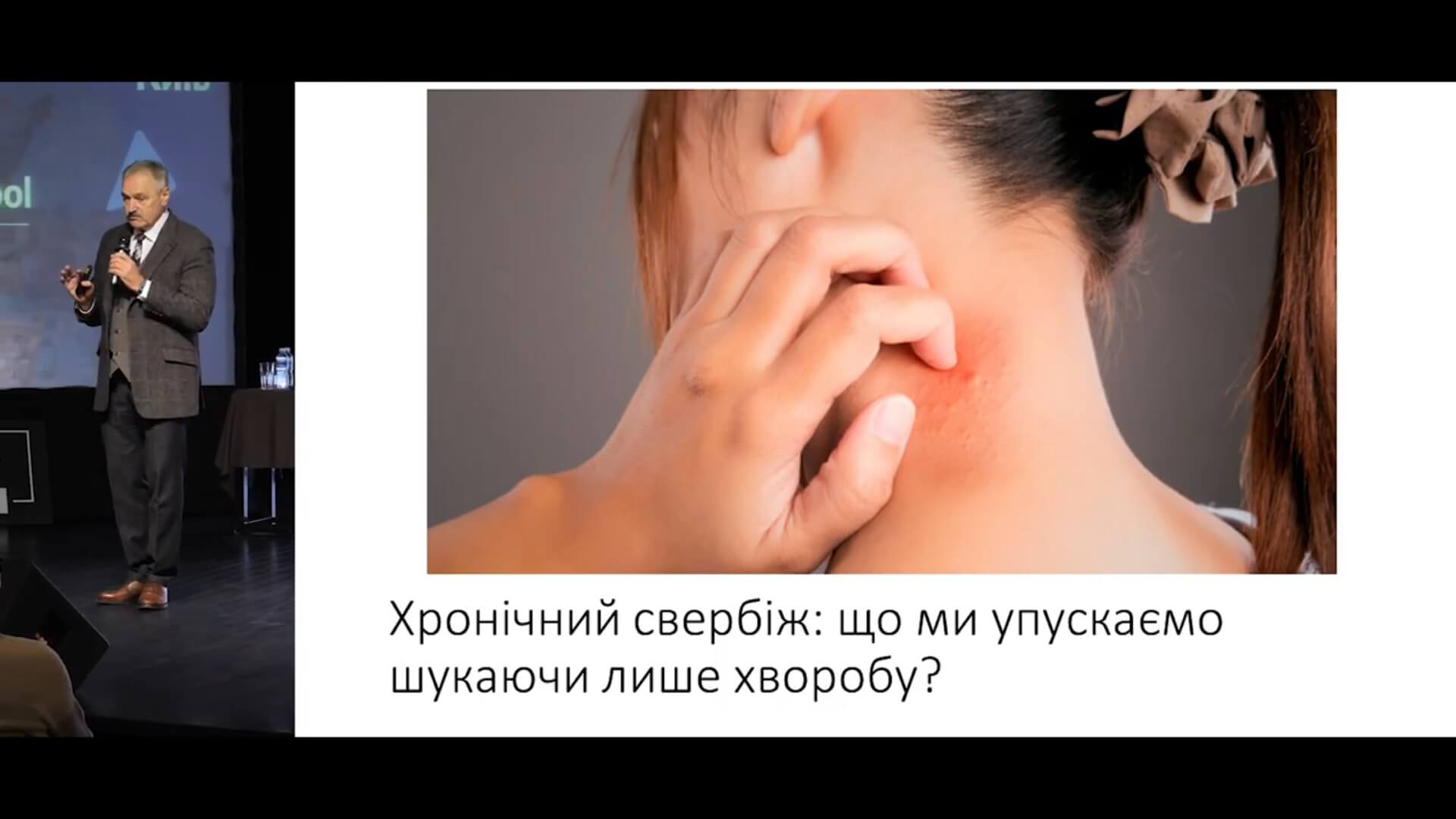 Хронічний свербіж: що ми упускаємо, шукаючи лише хворобу